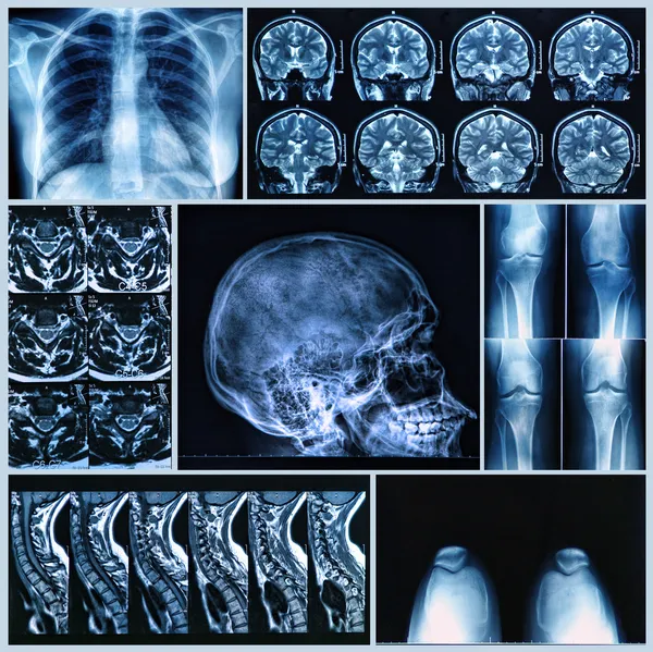 Рентген человеческих костей — стоковое фото