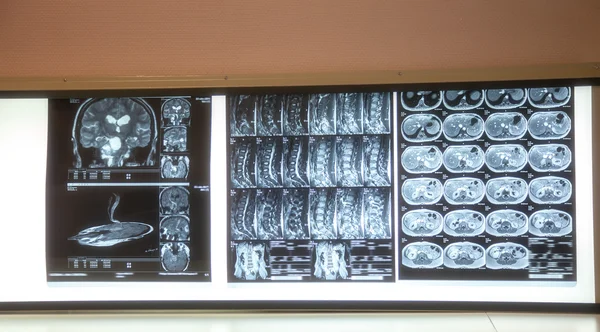 Рентгеновского сканирования — стоковое фото